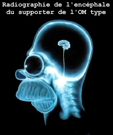 suporters